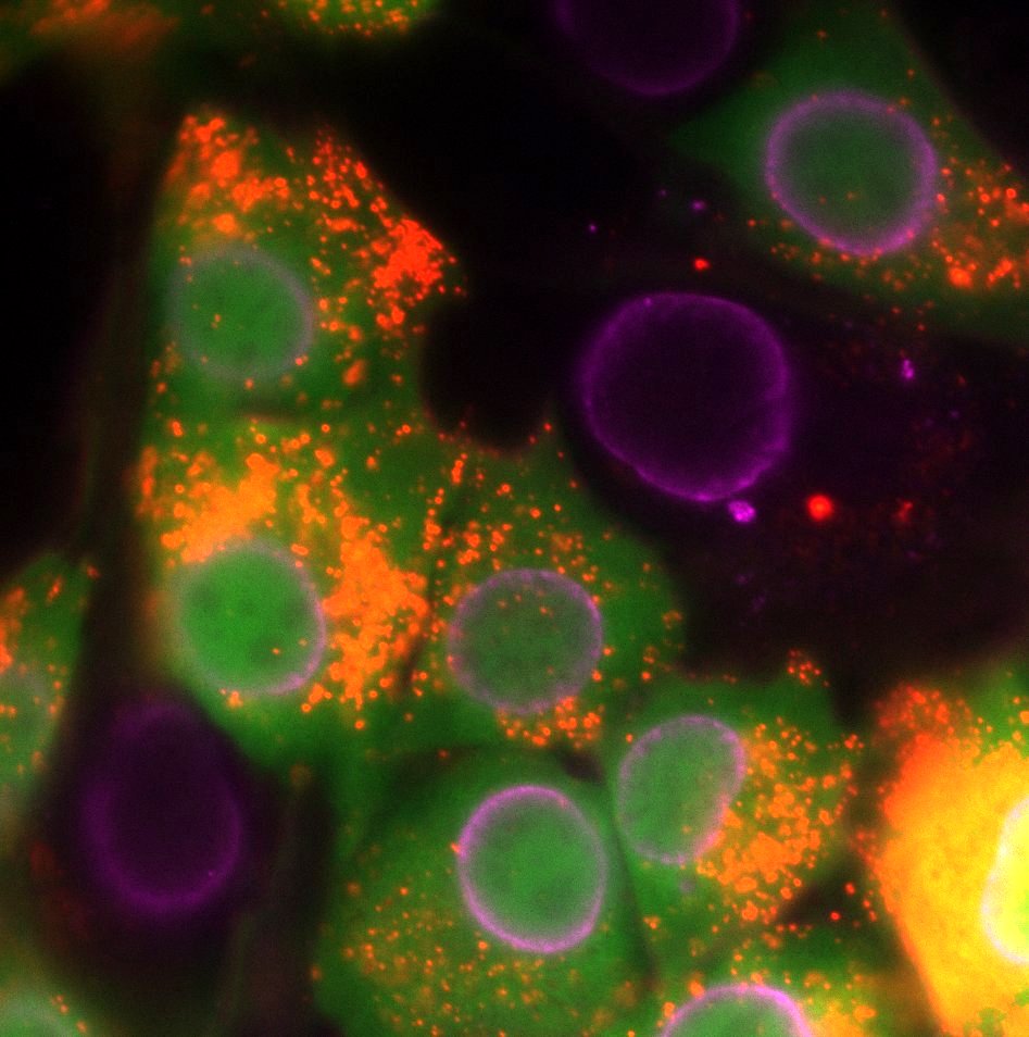 Fluorescence image of cells from the lab