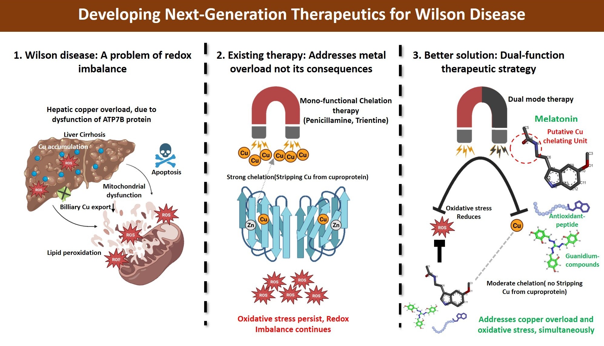 Wilson Disease
