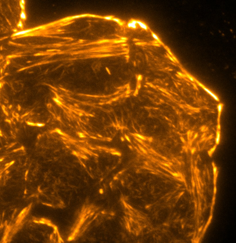 Fluorescently labelled actin in a cell